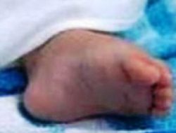 Hendak Membuat Susu, Balita Tercebur ke Sumur