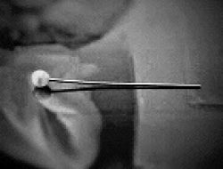 Asik Berdandan Siswi Ini Telan Jarum Pentul